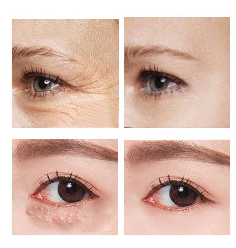 Beauty Eye Cream30mlwish Women's Skin Care Products - Fast shipping USA store