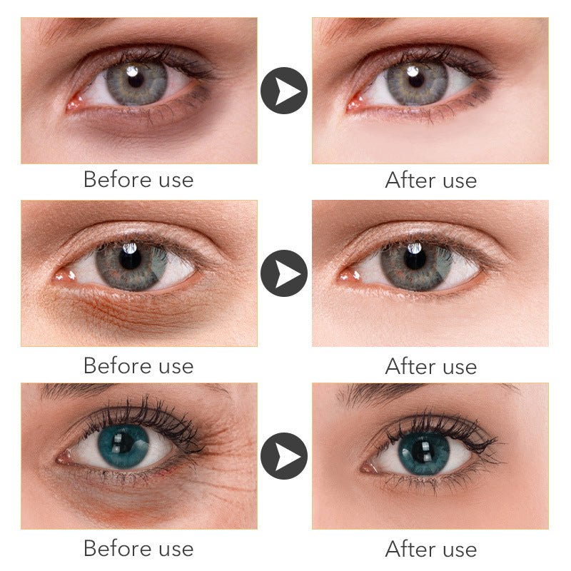 Beauty Eye Cream30mlwish Women's Skin Care Products - Fast shipping USA store